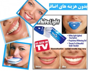 سفید کننده دندان Whitelight