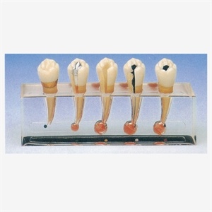 فروش انواع مولاژ و مدلهای اناتومی-مولاژ دندان سری سه عددی