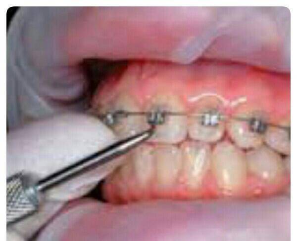 تخفیف ویژه خدمات دندانپزشکی