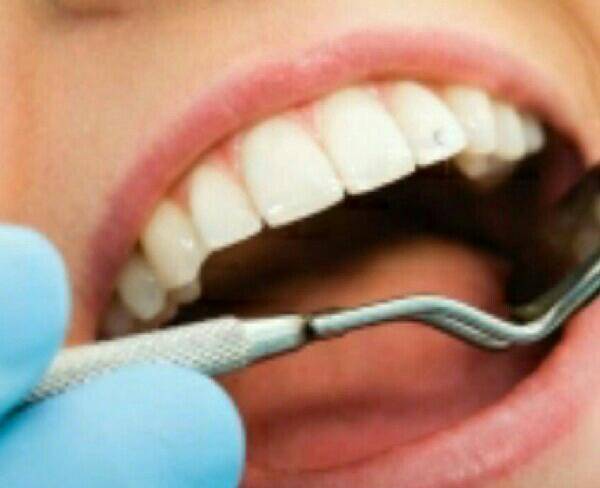 دندانپزشکی (۶۰% تخفیف ویژه) سعادت آباد