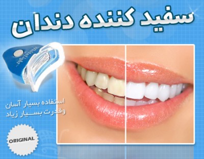 سفیدکننده دندان Whitelight
