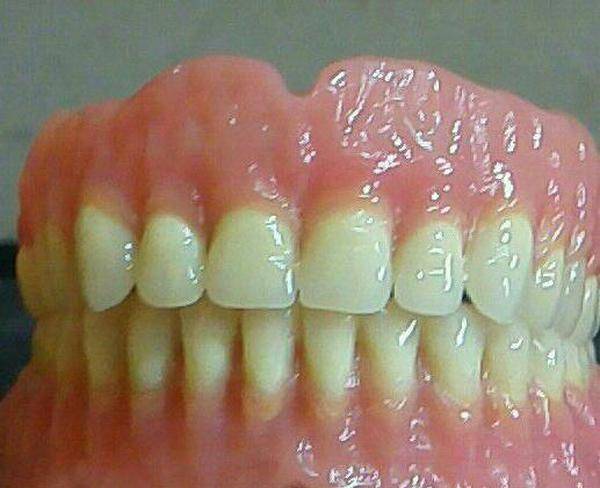 پروتز کامل و پارسیل دندان مصنوعی