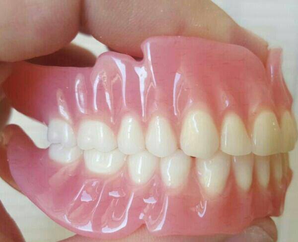 دندان مصنوعی(پروتز)