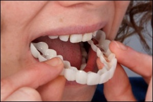 دندانپزشکی دکتر سجودی | لمینیت | ایمپلنت