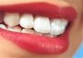 دندانپزشکی زیبایی و ترمیمی دکتر نیکخواه در اندیشه