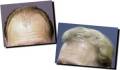 کلینیک پیوند موی طبیعی مشهد-یکی از مجهزترین کلینک های پیوند موی کشور-کمترین درد،کمترین تورم
