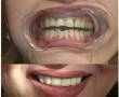 دندانپزشکی تا 50% تخفیف