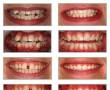 لابراتوار دندانسازی گرادیا