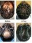 زاندروکس از ریزش موها جلوگیری می کند.موها را پرپشت و سالم نگه میدارد.
