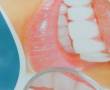 دندان سازی و دندان پزشکی نوین