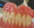 ساخت دندان مصنوعی از 300هزار تومان