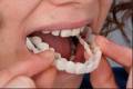 دندانپزشکی دکتر سجودی | ایمپلنت | لمینیت