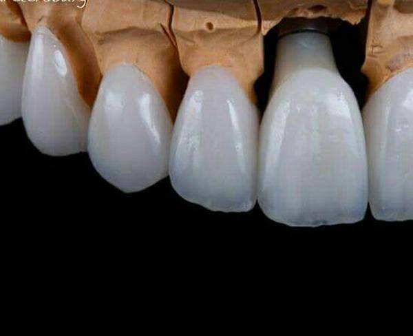 استخدام خانم جهت کار در لابراتوار دندانسازی