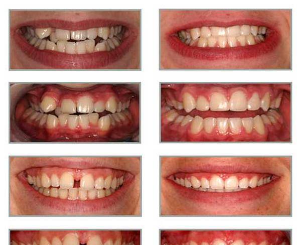 لابراتوار دندانسازی گرادیا