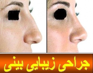 جراحی زیبایی بینی-صورت و ساکشن