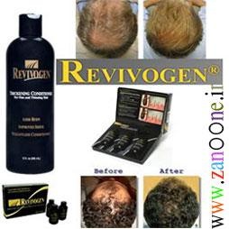 جلوگیری از ریزش موها و رویش مجدد آن با ریوایوژن