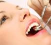 خدمات دندانپزشکی با 30% تخفیف