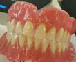 دندانسازی جعفرخانی