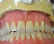 دندانسازی بیش از 35 سال سابقه خدمت